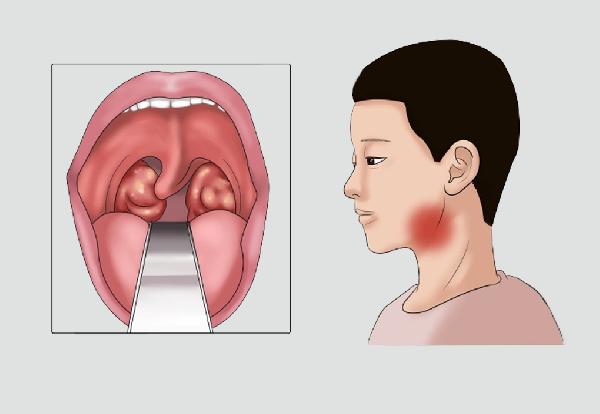 体内毒素多简单患病？引荐这5种食物协助排毒！